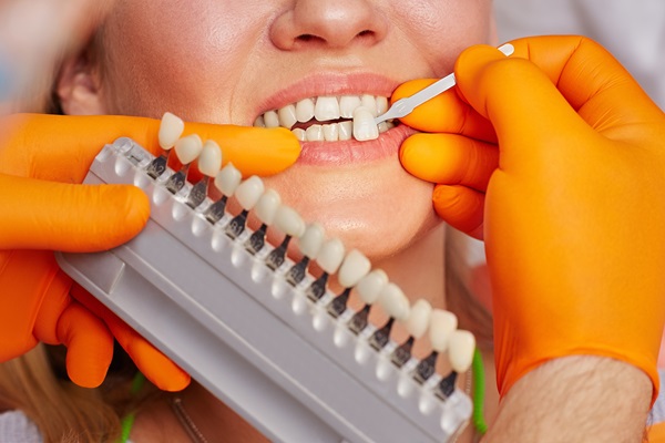 The Role Veneers Play In A Smile Makeover